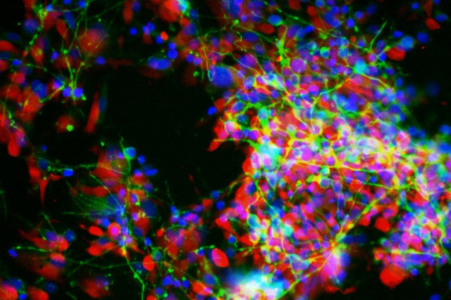 Timothy Hua's, “Brain Organoid in a Test Tube” 