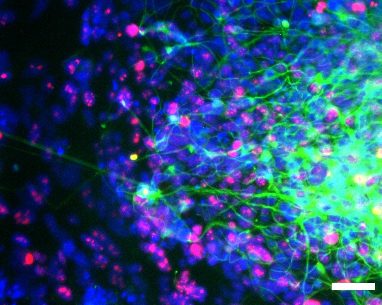 A healthy human brain organoid.